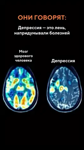 Всё не так просто, как кажется простому обывателю, незнакомому с принципами работы мозга. Я ленюсь или Я  истощен?🙄 Чаще всего это не лень - это истощение.Когда мозг перегружен настолько, что префронтальная кора просто «выключается», дофамин не реагирует даже на привычные радости, а вместо ясности появляется внутренний туман. А человек по инерции думает:«Надо постараться»,«Встать раньше»,«Взять себя в руки». Хотя тело делает единственно возможное - переходит в режим экономии. Убирает желание, сужает внимание, отключает эмоции, чтобы не сломаться окончательно. Мы живём в мире бесконечных возможностей, но всё ещё плохо понимаем, что «не могу» иногда значит не про слабость, а про перегруз.  Если долго не слышать сигналы психики, она начинает сдавать. Выгорание - не метафора и не «устал от жизни».Это реальное снижение нейронной активности, когда ресурса хватает только на выживание.И каждый раз, когда человек говорит себе «я ленивый» - он давит туда, где нужна не мотивация, а восстановление.🙈