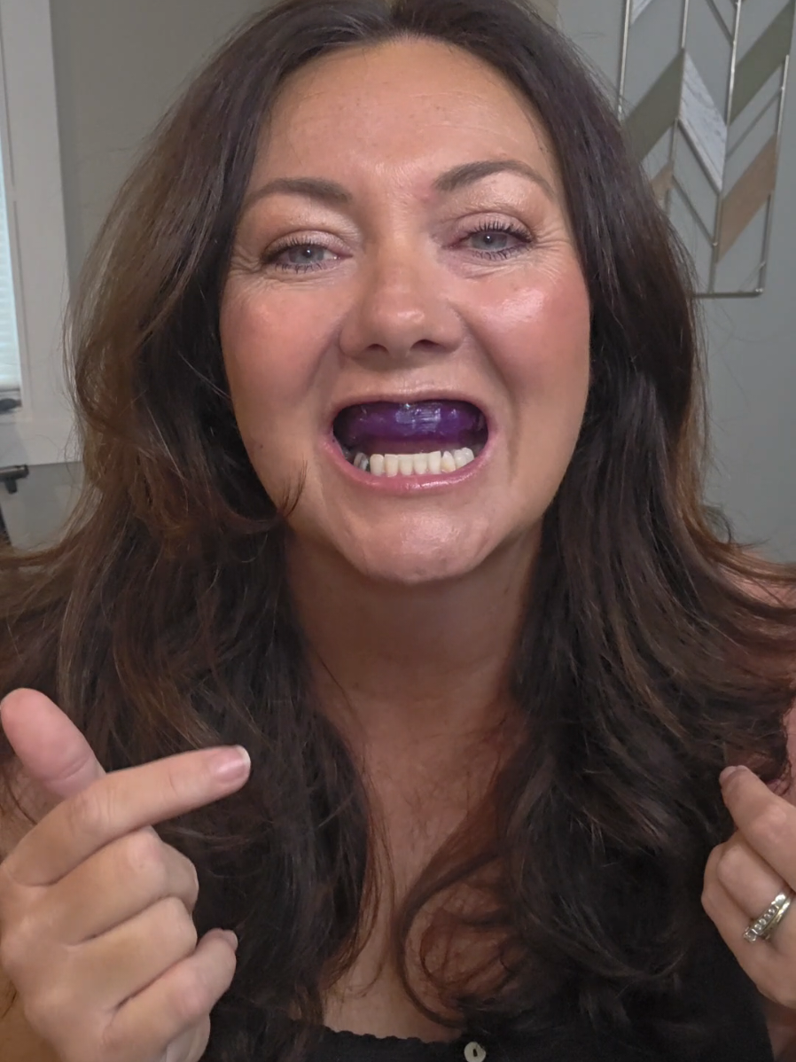 Insanity!!!! Im so impressed I didnt even have words!! #whiteningstrips #teeth #purplewhiteningstrips #tiktokshopfindsfyp #cleanteeth @Ceelike Oral Care 