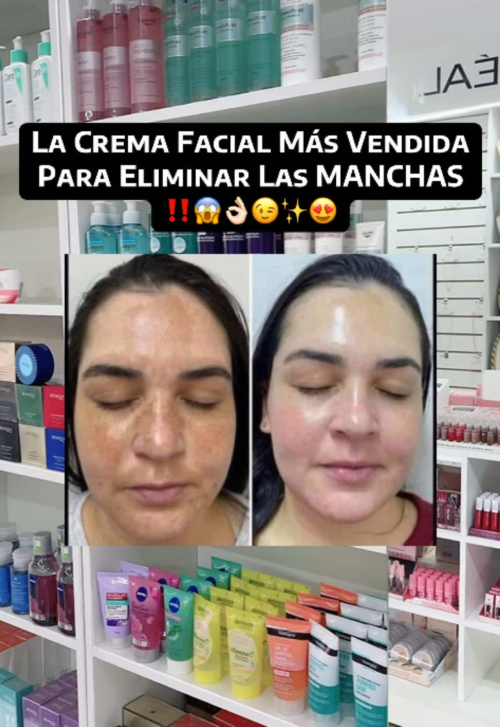 ‼️ES LA MEJORR‼️📲78.06.52.88 #cremafacial #despigmentante #eucerin #fyp #parati kei 