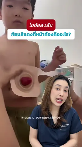 👩🏻‍⚕️ทำไมเด็กคนนี้ถึงมีก้อนเนื้อสีแดงตรงหน้าท้อง #doctor #หมอสกาย #ความรู้ 