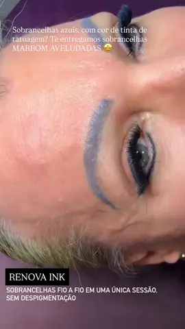 SOBRANCELHAS com micropigmentação antiga; azulada com cor de tinta de tatuagem e desenho inestético tem solução aqui no STUDIO CÉLIA REBLIN 💫🤩 A correção do post foi realizada com técnica RENOVA INK ✨ Neutralização estratégica ✨ Reconstrução da cor e do design ✨ Sobrancelhas Fio a Fio em uma única sessão ✨ Sem despigmentação ou remoção a laser Habilitada por @cleide.divina7 Vem você também! CÉLIA REBLIN | STUDIO DE MICROPIGMENTAÇÃO, SOBRANCELHAS & ESTÉTICA Saiba mais👇 (27) 99718 1700 | WHATS AGENDAMENTOS #sobrancelhas #sobrancelhasfioafio #sobrancelhasperfeitas #micropigmentacao #novaveneciaes