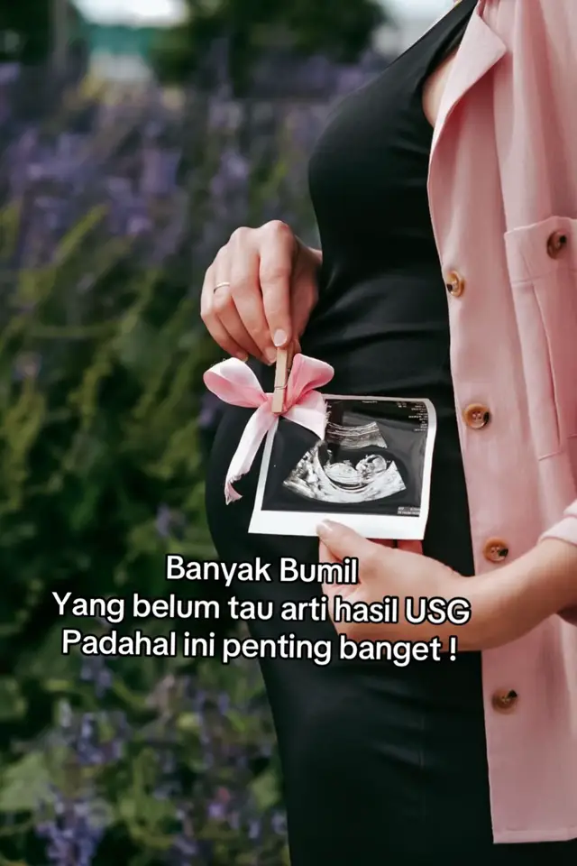Bumil sering USG tapi belum tau cara baca hasilnya, yuk save bumil biar ga bingung lagi baca hasil print USG si kecil 👶❤️ #usg #perkembanganbayi #MasyaAllahtabarakallah #usg5dimensi #rsupermatamadinasibuhuan 