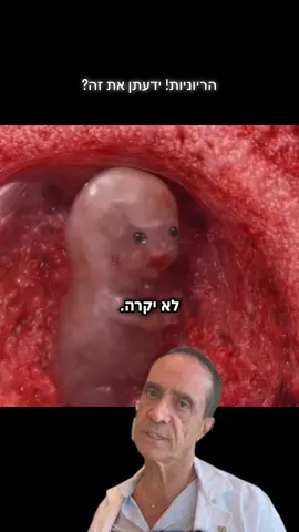 #ניפט #הריון #לידה #nipt #עובר https://lp3.babygenes.co.il