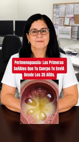 Perimenopausia: las primeras señales que tu cuerpo te envía desde los 35 años..#salud #consejosdesalud #méxico 