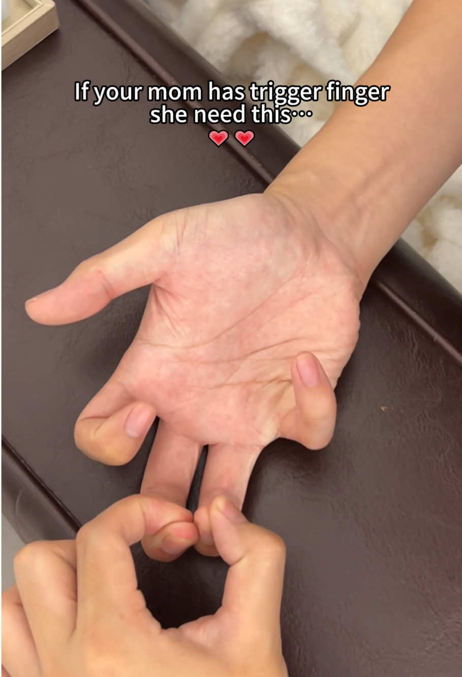 If your mother also has a trigger finger, give this to her.#triggerfinger #tiktokmademebuylt #carpaltunnel #handcare #motherdaygift 