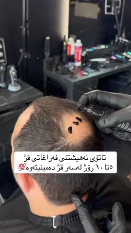 #erbil #slemani #karkuk #dhok  بۆداواکردن٠٧٥٠٧٢٦٢٤٤٢
