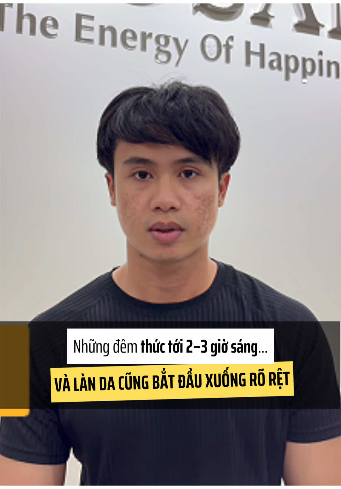 Từ những đêm thức tới 2–3 giờ sáng..Stress, thức khuya kéo dài khiến da bạn bắt đầu lên mụn, thâm và sẹo rỗ. #cosan #serumtrimun #serumasc #muntham #seoro 