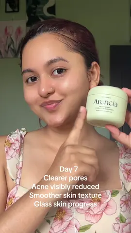 7 days with the Arencia Fresh Green Rice Mochi Cleanser ✨ My acne & clogged pores look SO much better already 😭🫶 Deep cleansing without stripping my skin. @Arencia @Arencia Influencers @YesStyleInfluencers @YesStyle  #arencia #mochicleanser #yesstyleinfluencers #arenciainfluencers #krisala22 