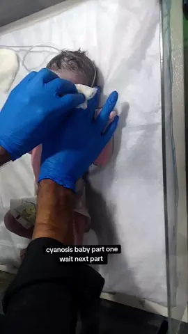 #baby oxygen problem #cynosis #100millonviews #unfreezemyaccount #