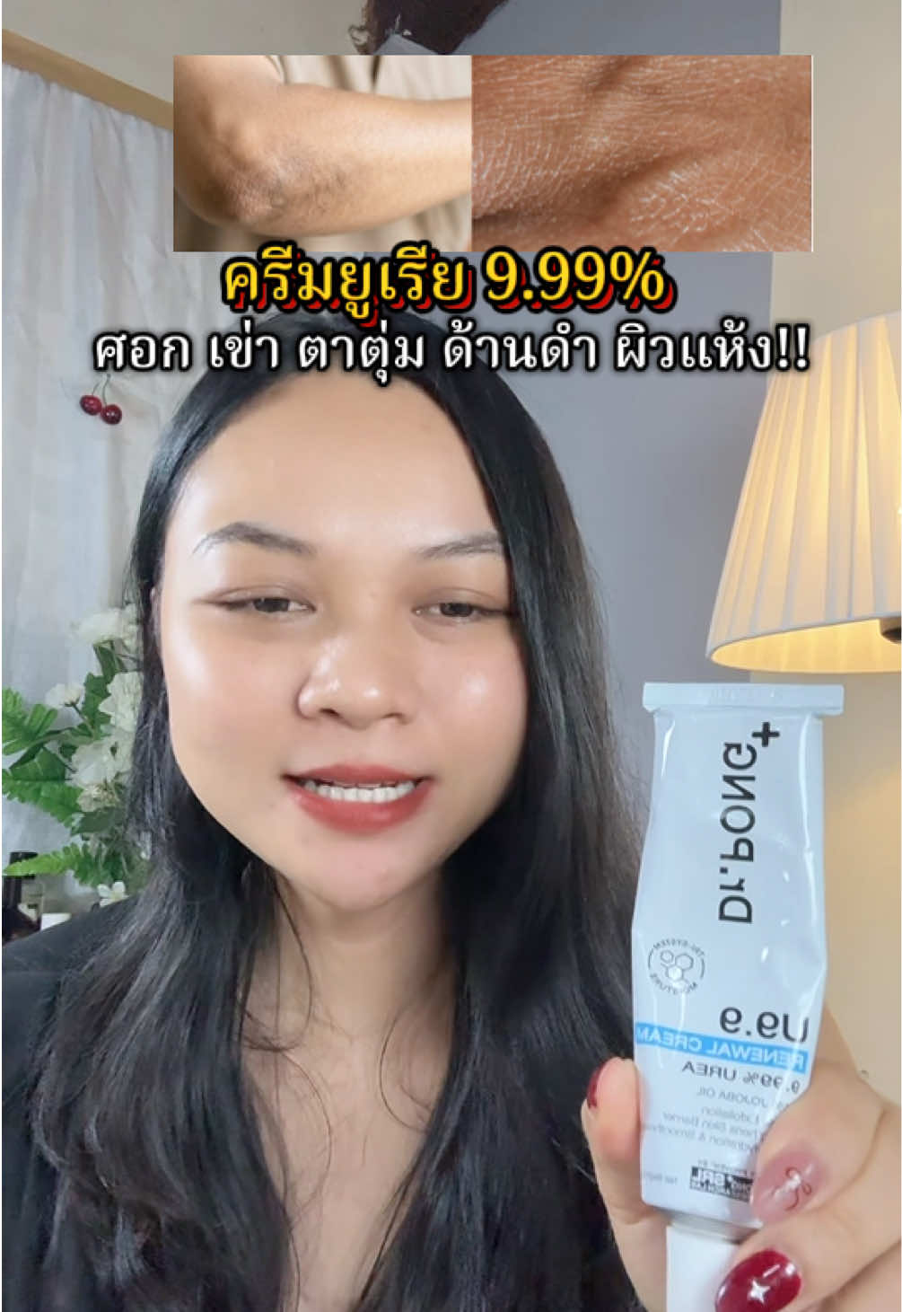 ให้ความชุ่มชื้นสูง  อวสานข้อศอกดำด้าน #ครีมยูเรีย #ยูเรียครีม #drpong #ข้อศอกดํา #ตาตุ่มด้าน 