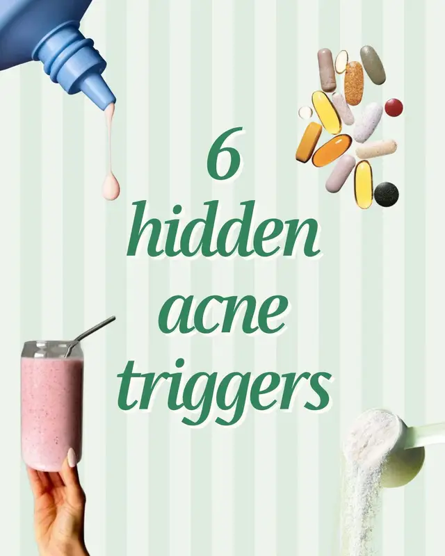 Hidden acne triggers might be the reason you’ve spent hundreds on new skincare to target acne… and none of it’s working. If you don’t remove the underlying triggers, no skincare product can remedy that. I’ve been criticised in the past for sharing the stat about B12 - 1 in 10 people who take it can develop acne. That was told to me by my dermatologist in person after it happened to me, but if you want the official source (PMID 26109103). Of course, doctors might suggest you take B12 if you’re deficient - and I’m not suggesting otherwise (I’m not a doctor, never claimed to be). But If you don’t have a medial need for B12, it’s worth considering you might be one of the 1 in 10. The rest of the triggers are so subtle you could be doing them for years without realising, thinking you have ongoing hormonal acne when you don’t actually don’t. That’s why I make the content I do - people don’t take these things seriously or realise how much havoc acne can wreak on your mental health, but I do 😇 #acnetips #skincaretips #glasskin 