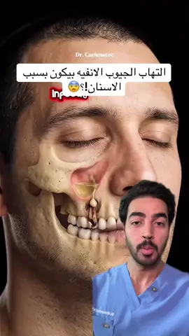 هل ممكن التهاب الجيوب الأنفيه يكون بسبب الاسنان!😨