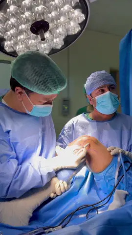 Meniscus surgery for tear.   Next option is Knee joint replacement.  #meniscus #acl #kneepain #kneesurgery #kneereplacement 