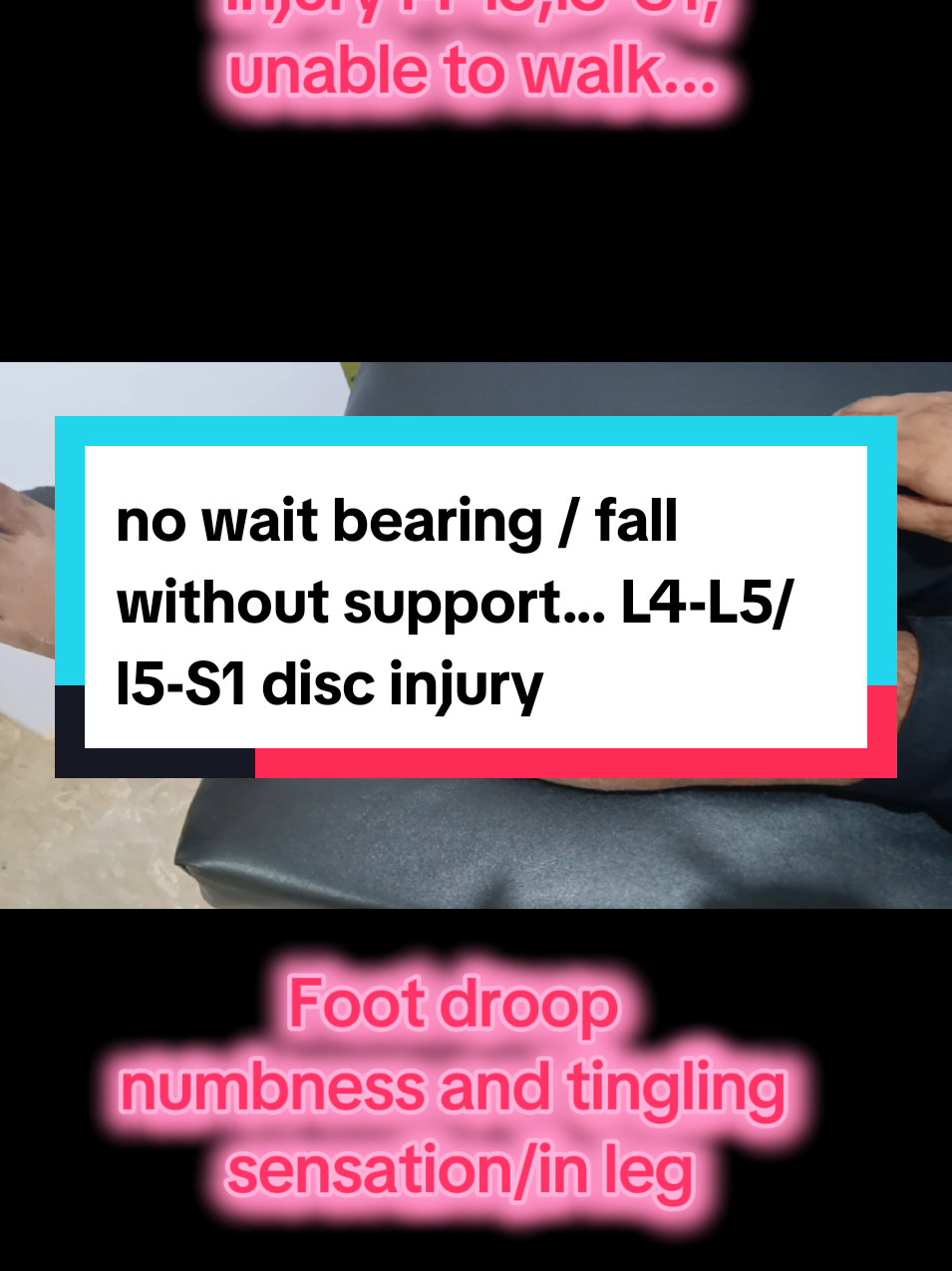 foot drop due to road accident...l4and 5-s1 disc bulge no wait on leg fall without support...#creatorsearchinsights #foryoupageofficiall #viraltiktok #nervechallenge #fyppppppppppppppppppppppp 
