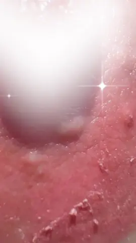 Các con vợ vào xem ca hồng sau bong 4 ngày tuổi của vợ anh nè 😋😋😋 #blushrose #hoaquynhbeauty #TruongQuynhHoa #uytintaonenthuonghieu #làmdep     