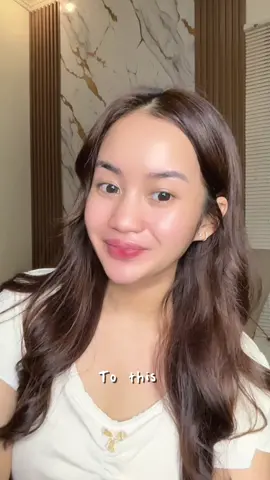 Bye bye kulit kusam 👋 @ONLYOU Store  #ONLYOU #skincare #ONLYOU 16% Niaci-liquo377