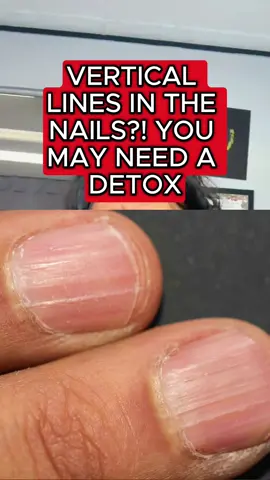 💅💅💅💅💅💅 🔗🔗🔗🔗🔗🔗🔗🔗🔗🔗🔗🔗🔗 Join my Skool🚌: https://www.skool.com/raw-maraby-health-club-1425/about 👉Discover How to Heal Your Body Naturally & Quickly https://miraherbals.info/pages/the-raw-maraby-circle ✅Get my newest book for FREE here: https://miraherbals.info/pages/8-steps-to-heal-opt-in Want full access to all of my lives? Join my Patron here: https://www.patreon.com/c/rawmaraby/about #HolisticHealing #DetoxYourBody #herbs #wellness #remedy #NaturalWellness #HerbalHealing #LymphaticHealth