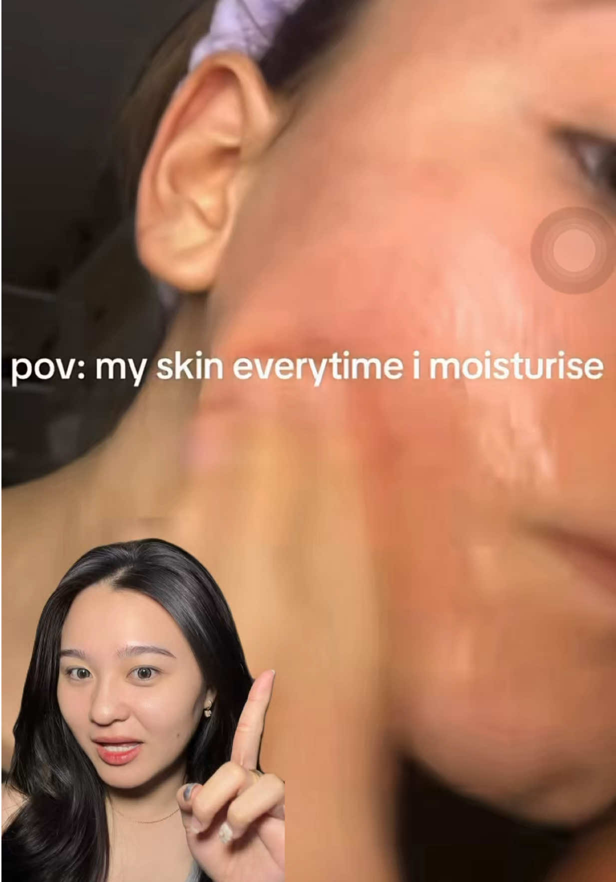 stop cara yg salah apalgi pakein produk yg ga bener kalau kulit lagi super sensitif! @Formulogic: Indonesia  #formulogicid #skinlogic #skincare #moisturizer