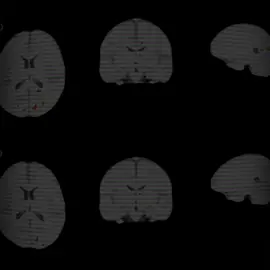 #Psychologie #Neuroscience #CerveauHumain 