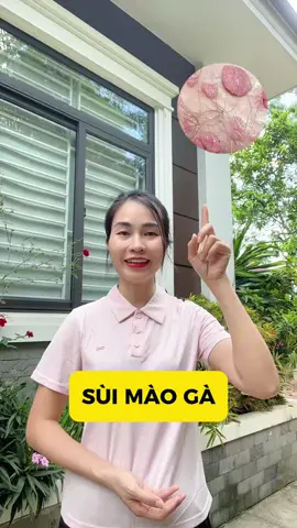 Để lâu sùi mào gà mọc thành chùm to #suimaoga #sùimàogà #chamrungsuimaoga 