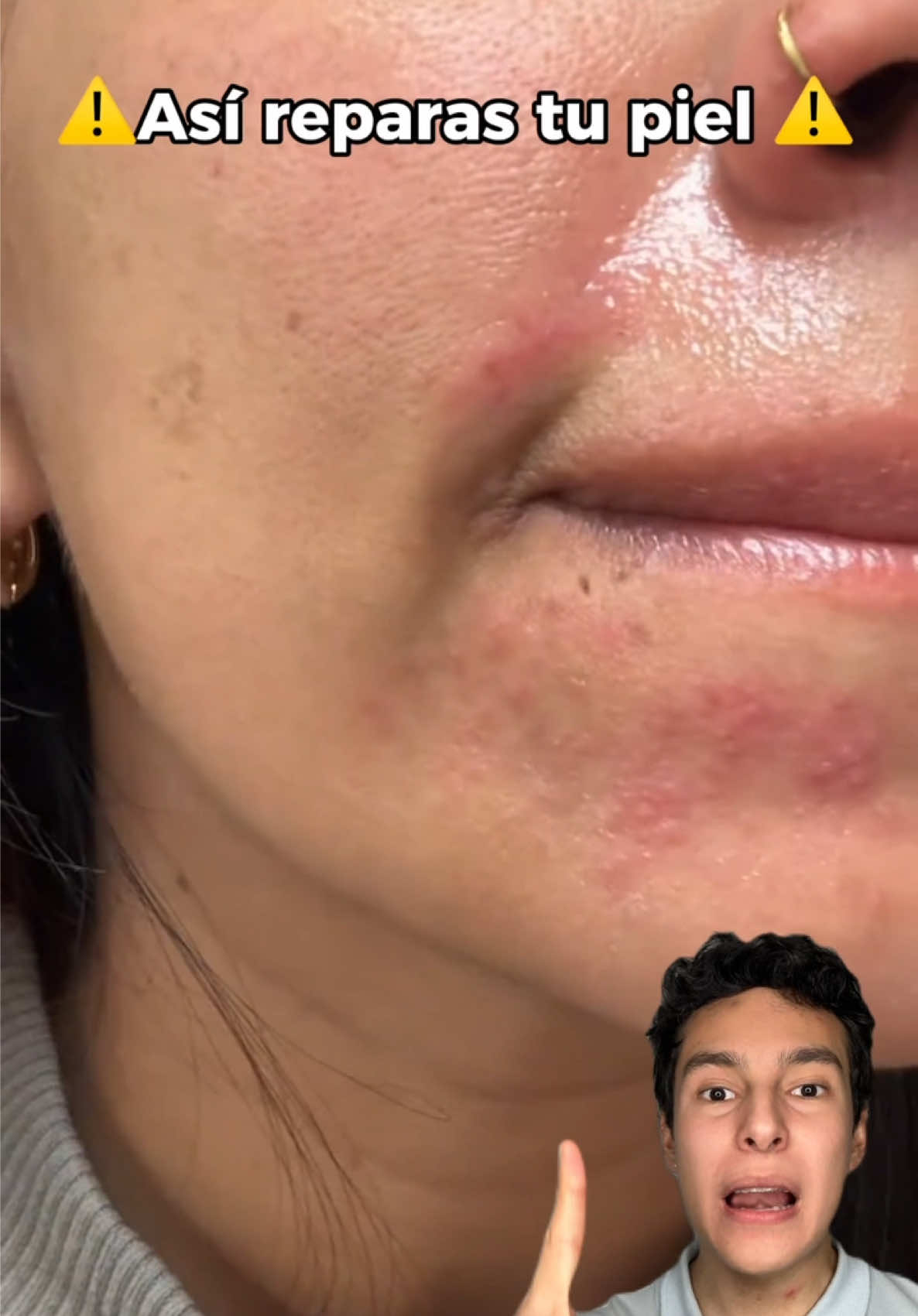 A veces pensamos que la piel está “seca” y ya… pero en realidad puede ser una barrera cutánea dañada. 🫠 Para eso está la crema @Atopeel y me gusta porque no solo hidrata, sino que ayuda a restaurar la barrera de la piel gracias a ingredientes como ceramidas, escualeno y ectoína ✨ Lo mejor con 21 ingredientes naturales🍃 #skincare #glownatural #pielsaludable #beautyroutine #pielradiante