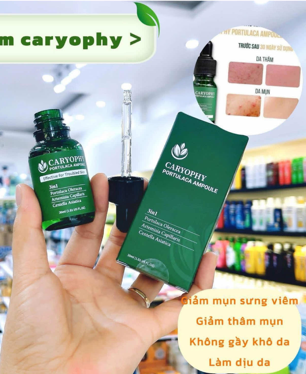 Serum Caryophy chân ái cho làn da dầu mụn✨✨#serum #caryophy #dadaumun #skincare #hauhoang8686 