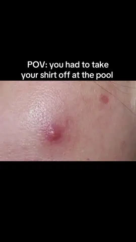 Help your skin out 
