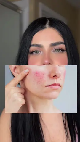 Conoces tu tipo de piel ?  Not every viral product is right for your skin 💚✨ That’s why I prefer gentle daily pore care that works with my skin, not against it. @mixsoon global @mixsoon  #mixsoon #kbeauty #skincare #cleansingoil #cleansingfoam 