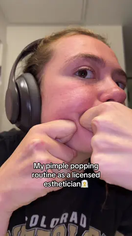 I’ve noticed the healing of my pimples improve significantly since doing this routine!!! #skincaretok #pimplepopping #pimplepopper #estheticiantips #pimples 