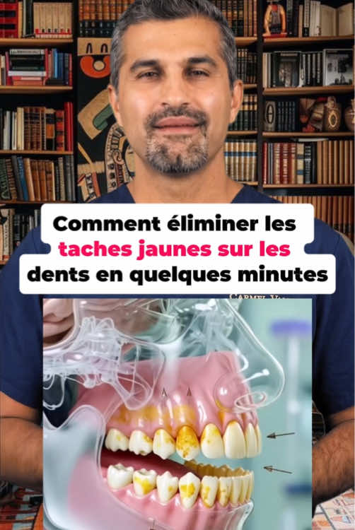 Comment éliminer les taches jaunes sur les dents en quelques minutes#santé #bienêtre #conseilsanté #france #fyp