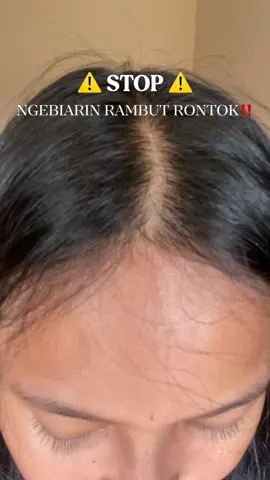 udh gak takut sisiran lagi, karena pake shampo @Torrential Official  #shampoo #ShineStregthenHairSerum #rambutrontok #kebotakan 