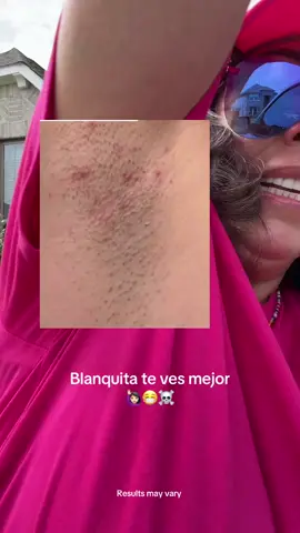 El desodorante de Medicube que te hace oler rico y te ayuda blanquear esa axilas oscuras.  Ahora entiendo porque se agota tanto este desodorante. #medicube #dealsforyoudays 