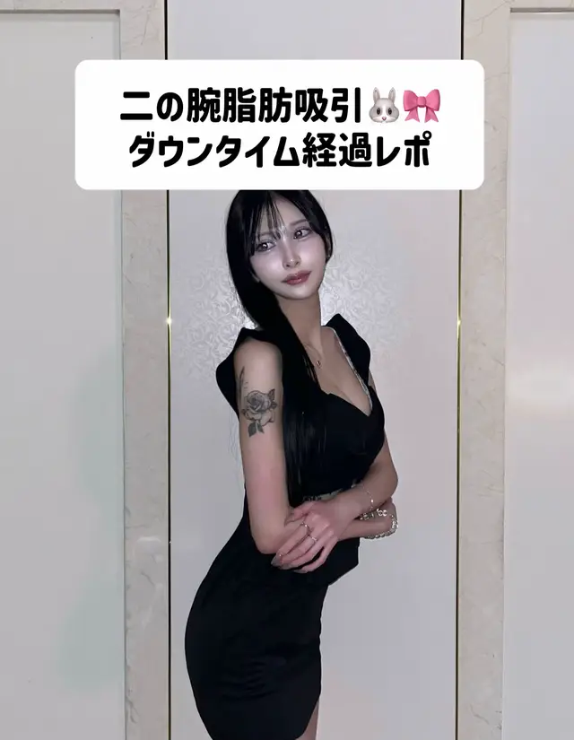#脂肪吸引 #二の腕痩せ #二の腕 