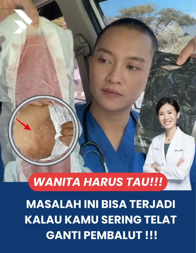 Banyak wanita yang tidak menyadari bahwa kebiasaan malas mengganti pembalut saat haid bisa menjadi salah satu faktor yang membuat area selangkangan tampak semakin gelap.  Sebagai dokter, saya sering mengingatkan bahwa pembalut yang digunakan terlalu lama akan membuat area kewanitaan dan selangkangan menjadi lebih lembap. Kondisi lembap yang berkepanjangan dapat meningkatkan gesekan antara kulit, pembalut, dan pakaian dalam. Gesekan berulang inilah yang dapat memicu iritasi ringan yang sering kali tidak disadari. Iritasi ini yang bbisa timbulkan hiperpigmentasi atau penggelapan kulit diarea selangkangan. Menjaga area kewanitaan tetap bersih dan kering bukan hanya penting untuk kesehatan, tetapi juga membantu rasa percaya diri. #kewanitaan #edukasi #dokter #pembalut #faktawanita 
