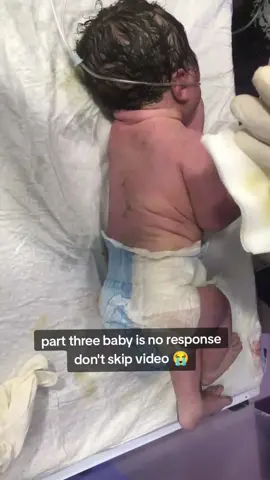 #nicubaby #dontremovemyvideotiktok #nicu #viral #unfreezemyaccount 