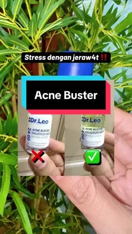Patutlah viral #acnebuster  #creamjerawat  #drleo 