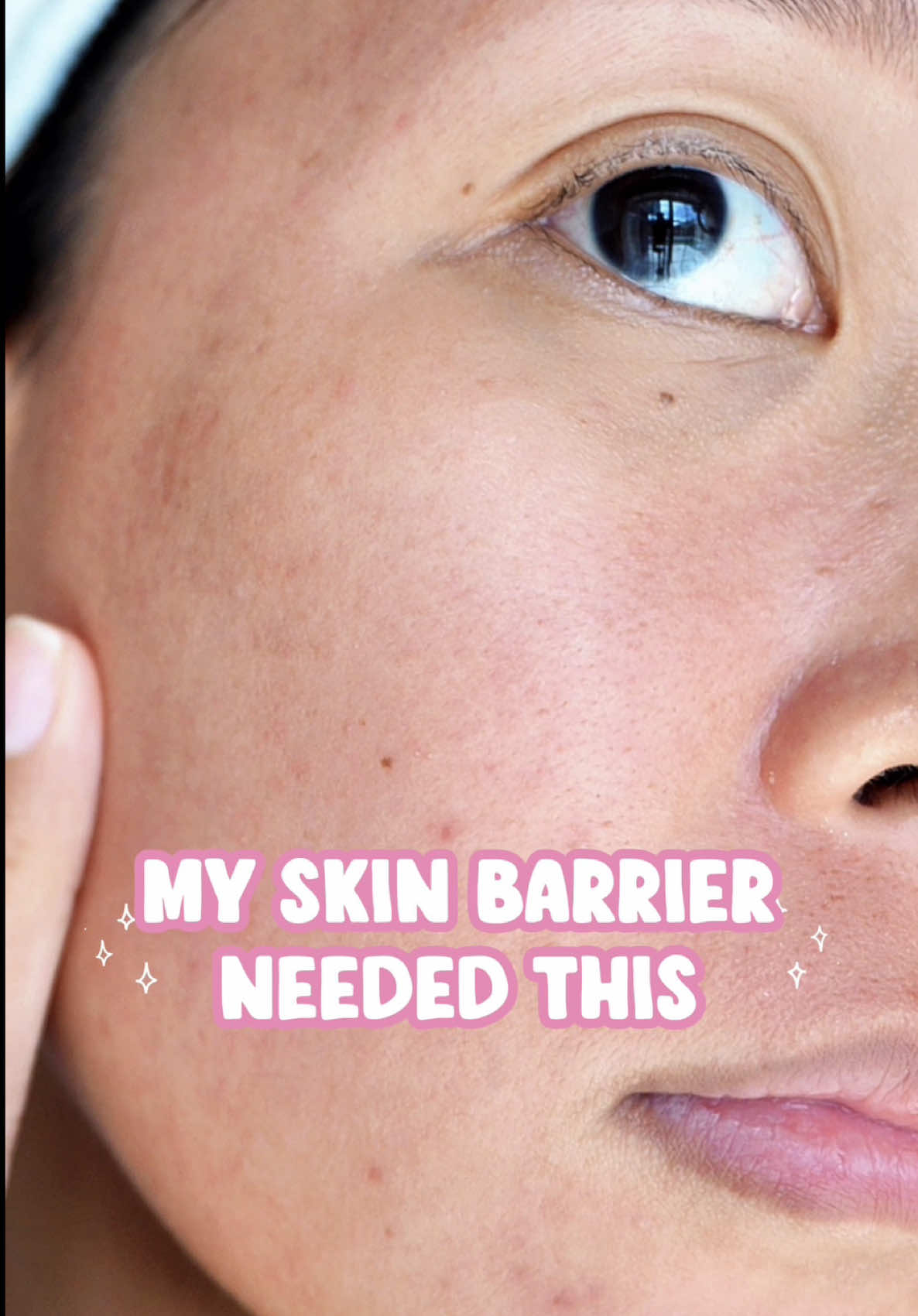 Dry, irritated, sensitive skin days call for barrier care 🫶 @pure K Official  I’ve been using the PURE K Panthenol 10% CICA Repair Cream for lightweight hydration that feels calming, comfortable, and not greasy. Perfect for when my skin feels stressed and needs extra support. #SkinBarrier #D-Panthenol #CICA #Hydration #RepairCream  