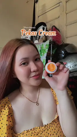 If you have Pekas, Dark spot, Acne marks must try this pekas cream🧡✨ #ultraderma #ultradermapekastoner #ultradermapekascreamremover #scmph #teamshecreates 