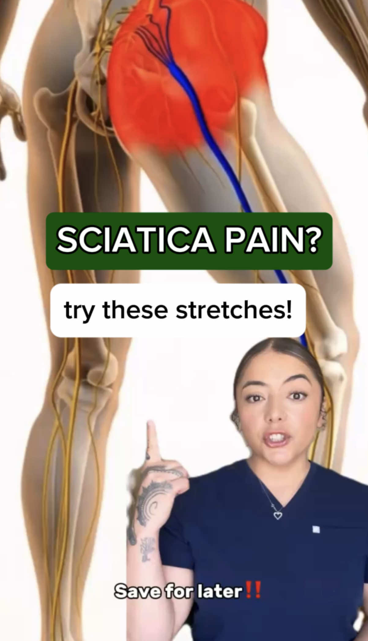 do you have sciatic pain? Try these stretches TODAY ‼️#chiropractor #sciatica #sciaticarelief 