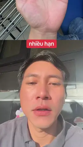 nhiều hạn #xuhuong #nhandien #xemchitay #tuong #tuvi 