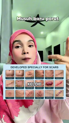 #parutjerawat #keloid #krimparu 