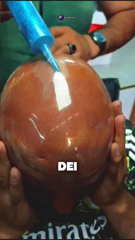 DEI UM NOME FALSO DE BEBÊ PARA MINHA IRMÃ GEMEA PARAR DE ME COPIAR #historias #historiasreddit #reddit #historiasreais #fy