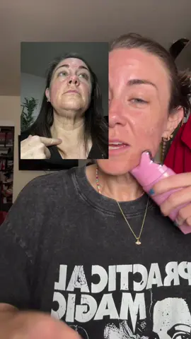 Get a snatched neck, jawline, and cheeks with the brand new #pdrn #neckcream from @medicube US Store #guasha 