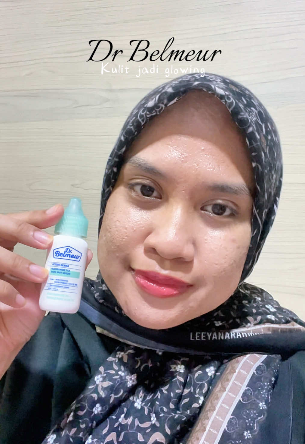 No wonder la ramai yang suka pakai serum ni !! Dia punya result buat kulit nampak sihat 💕🙀 #drbelmeur #darksportserum #tranexamicacid #hyperpigmentation 