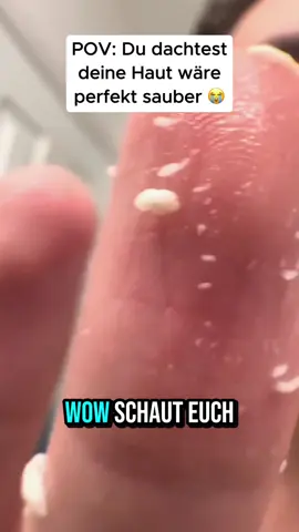 Sommer kommt, aber meine Füße waren noch nicht ready#oddlysatisfying #basislab #porecleansing #deadskinremoval #blackheads 