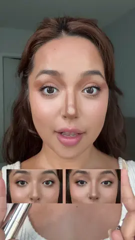 Phẫu thuật mũi bé tí bằng cách đánh Button Nose contour  #timephoriavn