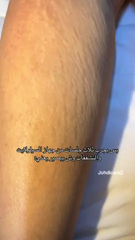 لا اسمح ولا احلل بحفظ مقاطع و تجارب عملائي ‼️لطلب عبر الرا//بط في البايو ✅ لا يوجد الطلب عبر الخاص 🚫