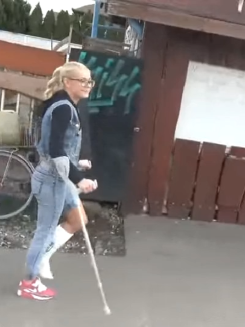 #gips #gipsfuß #platre #gesso #gipsz #brokenfoot #crutches #krücken