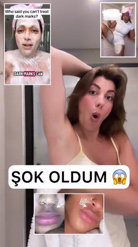 BİZ NİYE BU KADAR GEÇ KALDIK BU KOJİK ASİT’e SORARIM SİZE 🤭🥹 Muhteşem bir içerikmiş ama doğru kullanıldığında ve oranlandığında 👍  #keşfet #lekeaçma #lekebakımı #trend  reklammarkagösterdim