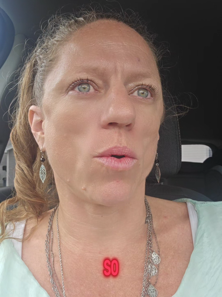 This is why women can't get diagnosed. We get steamrolled at the doctor. Looking back, its insane that my original issue didn't even get addressed cause what do you mean my swollen ankles got diagnosed as anxiety #mylife #waterretention #lipedema 